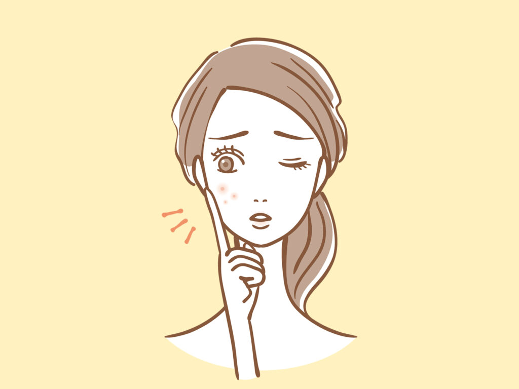 ニキビを嫌がっている女性